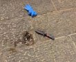 שוטר בירושלים מנע פיגוע ונפצע: "המחבל שלף סכין תוך שניות"